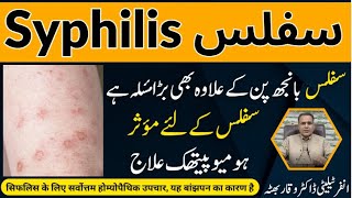 Syphilis سفلس उपदंश Homeopathic Treatmennt By Dr Waqar Bhutta In Urdu  Hindi [upl. by Allehcim205]