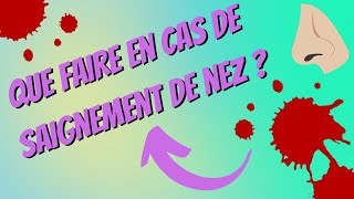 Que FAIRE en cas de SAIGNEMENT de NEZ [upl. by Chema]