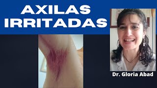 AXILAS IRRITADAS ¿HONGO O DERMATITIS ¡Me pica DEBAJO DEL BRAZO CÓMO SOLUCIONARLO [upl. by Eenot]