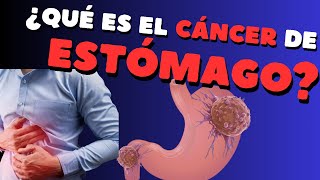 ¿Qué es el cáncer de estómago [upl. by Beedon]