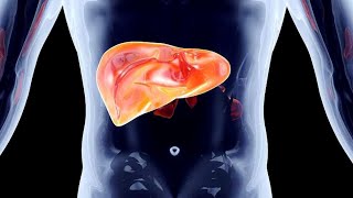 Mayo Clinic Minute When colon cancer spreads to the liver [upl. by Asyl992]