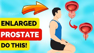 Prostate Exercise  The 4 Types of Prostate Exercises for Enlarged Prostate [upl. by Judi]