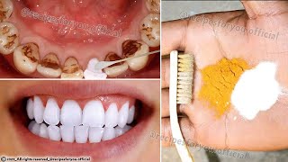 Secret that Dentists dont want you to know Remove Tartar and Teeth Whitening in just 2 minutes [upl. by Odel]