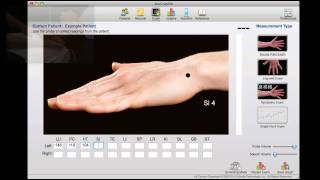 AcuGraph Acupuncture Point Measurement [upl. by Nigam135]