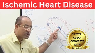 Ischemic Heart Disease  Myocardial Infarction  Cardiology🫀 [upl. by Berrie]