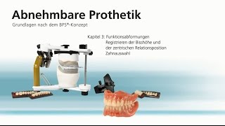 Abnehmbare Totalprothetik – Kapitel 3 [upl. by Graubert]