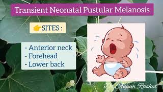 Newborn Baby Rash  Part 2  Transient Neonatal Pustular Melanosis Cause Symptoms amp Treatment [upl. by Rojam987]