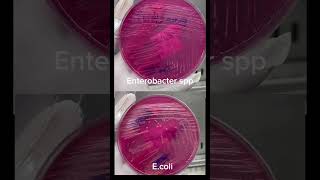 Ecoli và Enterobacter spp khác nhau ra sao Đố bạn trả lời đúng labreport ecoli enterobacter [upl. by Iruyas832]