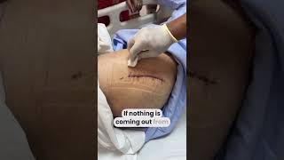 How to do surgical dressing at home like a DOCTOR  wounddressing totalhipreplacementsurgery [upl. by Alledi585]