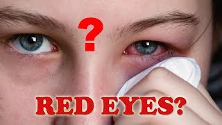 Red eYe  Hindi [upl. by Latimore954]