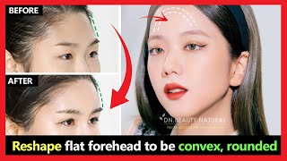 How to Reshape flat forehead to be convex rounded  Fix flat face to the oval face naturally [upl. by Onaicram]