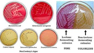 MacConkey Agar [upl. by Haleemak373]