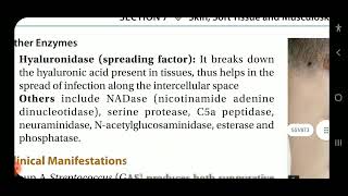 Apurba S Sastry Beta hemolytic streptococcal infections [upl. by Ardnua]