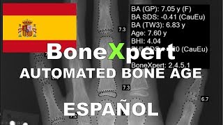 Edad ósea automatizada con BoneXpert  preciso y fácil [upl. by Narbig641]