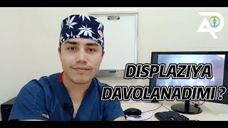 displaziya dysplasia дисплазия Displaziya davolanadimi [upl. by Siroved]