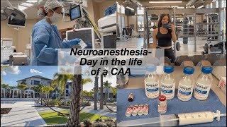 Behind the Scenes Neurosurgery with an Anesthesiologist Assistant Day in the life vlog [upl. by Akinhoj10]