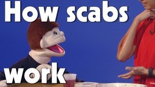 How Scabs Work  Kids Health  The Friday Zone  WTIU  PBS [upl. by Previdi]