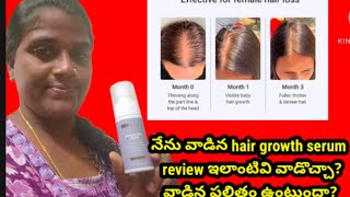 నేను వాడిని hair growth serum reviewహెయిర్ గ్రోత్ సిరం రిజల్ట్ ఎలా ఉందో చూద్దాం రండి [upl. by Edwyna]