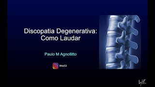 DISCOPATIA DEGENERATIVA COMO LAUDAR [upl. by Vasos792]