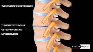 Wat gebeurd er met de ouder wordende wervelkolom [upl. by Iz]