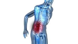 Back Pain Linked to Knee Pain [upl. by Jary]