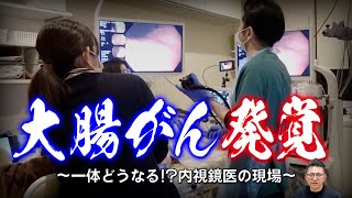 【内視鏡医のリアルな解説】がんと診断されたら… どうなる⁉︎大腸がん 突然の告知〜ケース別に徹底解説 教えて久津川先生 No337 [upl. by Gothard504]