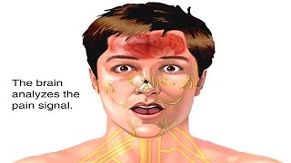 How Pain Works Animation  Pain Sensation Pathway and Brain Respond to Pain Video  Nervous System [upl. by Azila]