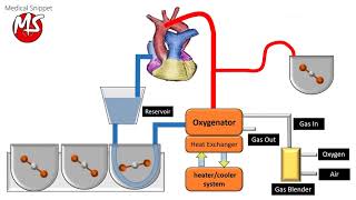 Cardiopulmonary bypass CPB circuit [upl. by Imij]