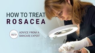 How to Treat Rosacea  Advice from a Skincare Expert [upl. by Dry]