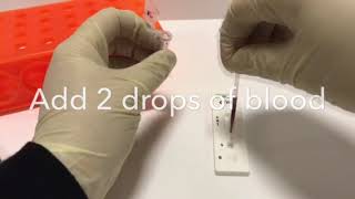 Troponin I Semi Quantitative Rapid Test [upl. by Anidam87]