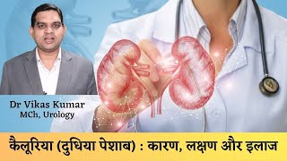 What is Chyluria Reason Symptom amp Treatment  यानी दुधिया पेशाब क्या है Dr Vikas Kumar Urologist [upl. by Eirallih]