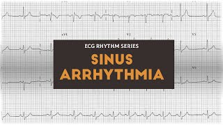 Sinus Arrhythmia  ECG Rhythm Series [upl. by Eiramlehcar]