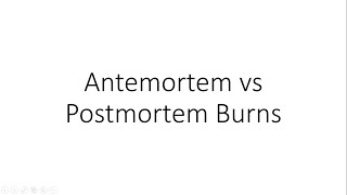 Antemortem vs Postmortem Burns  Forensic Medicine FMT [upl. by Joell]