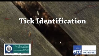 Tick Identification [upl. by Ursas385]