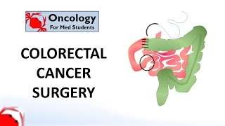 Colorectal Cancer Surgery principles and types [upl. by Yra]