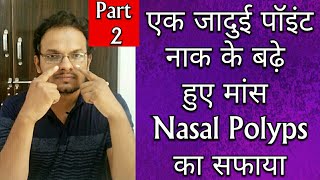 Single Acupressure Point For NASAL POLYPS In Hindi  One Point To Cure Nasal Polyps  2 [upl. by Ynaffit537]