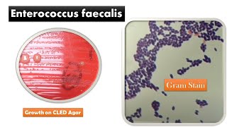 Enterococcus faecalis Colony Morphology and Gram Staining [upl. by Eylsel]