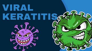 Viral keratitis  Virus  OPHTHALMOLOGY PrepLaddermedpg marrowmed [upl. by Nadruoj427]