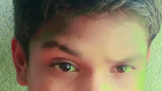 Video  सुहागरात सुपर मनी  Khesari Lal Yadav  Suhagrat Super Mani  Bhojpuri Song 2024 [upl. by Acinomed]