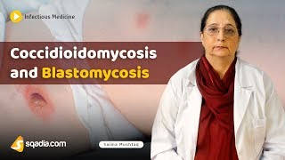 Coccidioidomycosis and Blastomycosis  Internal Medicine Infectious Disease  VLearning [upl. by Aihsrop812]