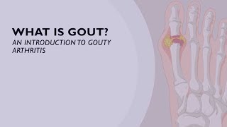 What is Gout An Introduction to Gouty Arthritis 1 of 6 [upl. by Winthrop]