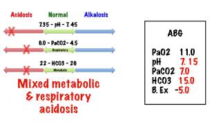 Respiratory ABG Interpretation [upl. by Neron259]