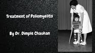 Polio Treatment  Poliomyelitis Treatment [upl. by Wittie]