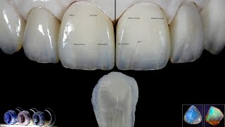 The Staining technique in imitating natural teeth the IPS Ivocolor system explained [upl. by Primo501]