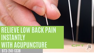 Relieve Low Back Pain Instantly with Acupuncture [upl. by Peder442]