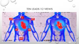 12 Lead ECG Episode 2  Lead Placement [upl. by Martell]