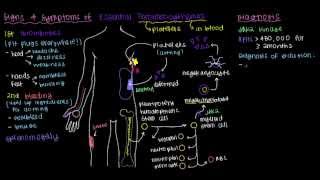 What is essential thrombocythemia [upl. by Ojillek]