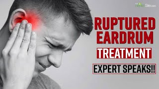 Ruptured Eardrum What Treatment According To Expert Should Be Done For Perforated Eardrum [upl. by Toombs]