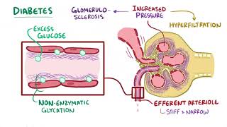 WWW DOWNVIDS NET Chronic kidney disease chronic renal failure causes symptoms diagnosis treatme [upl. by Ahsienahs]