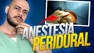 Como é feita a anestesia PERIDURAL [upl. by Polito185]